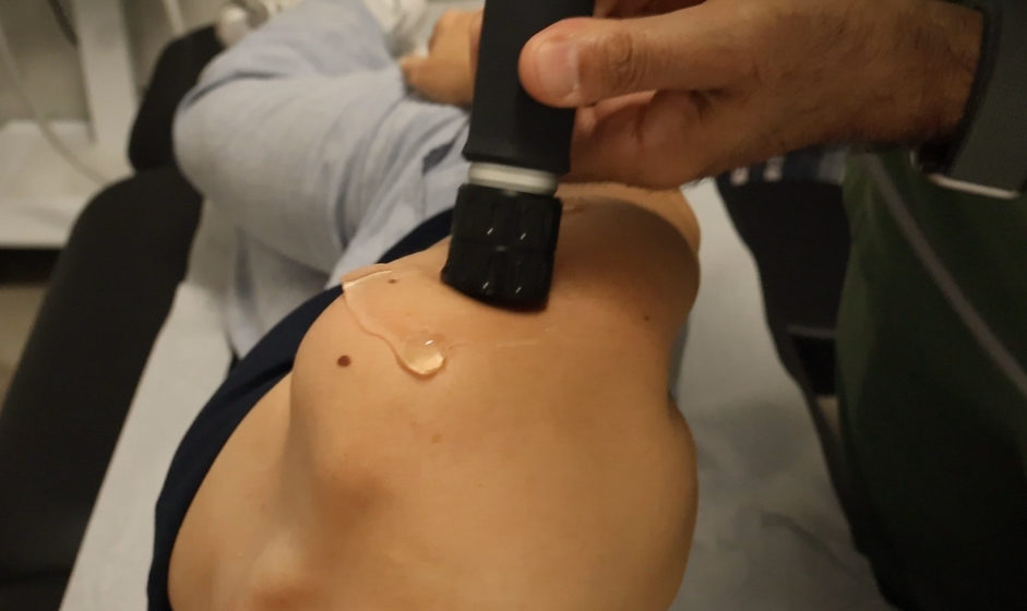 Focused shockwave therapy applicator treating a patient's shoulder for calcific tendonitis at York Rehab Clinic in Richmond Hil