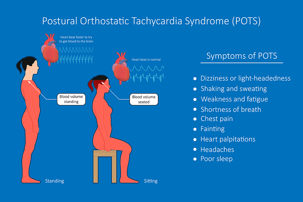 Pots Postural Orthostatic Tachycardia Syndrome