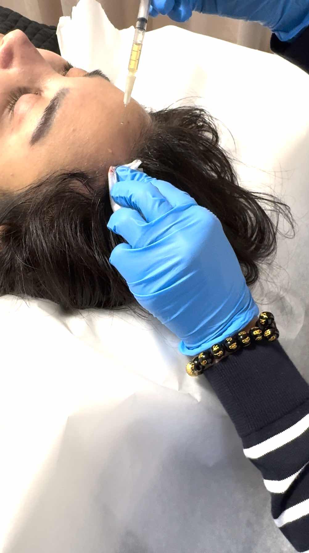 PRP Treatments Hair loss in Richmond Hill