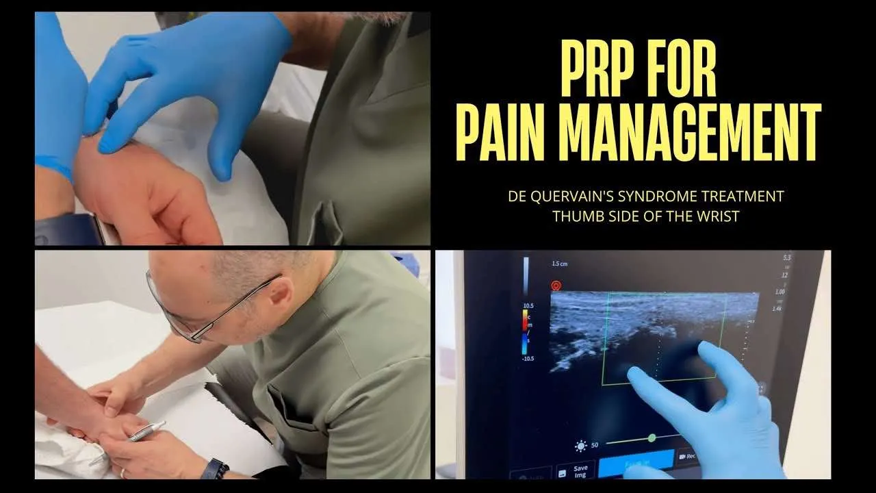 PRP Treatment for Chronic Wrist Pain in Richmond Hill