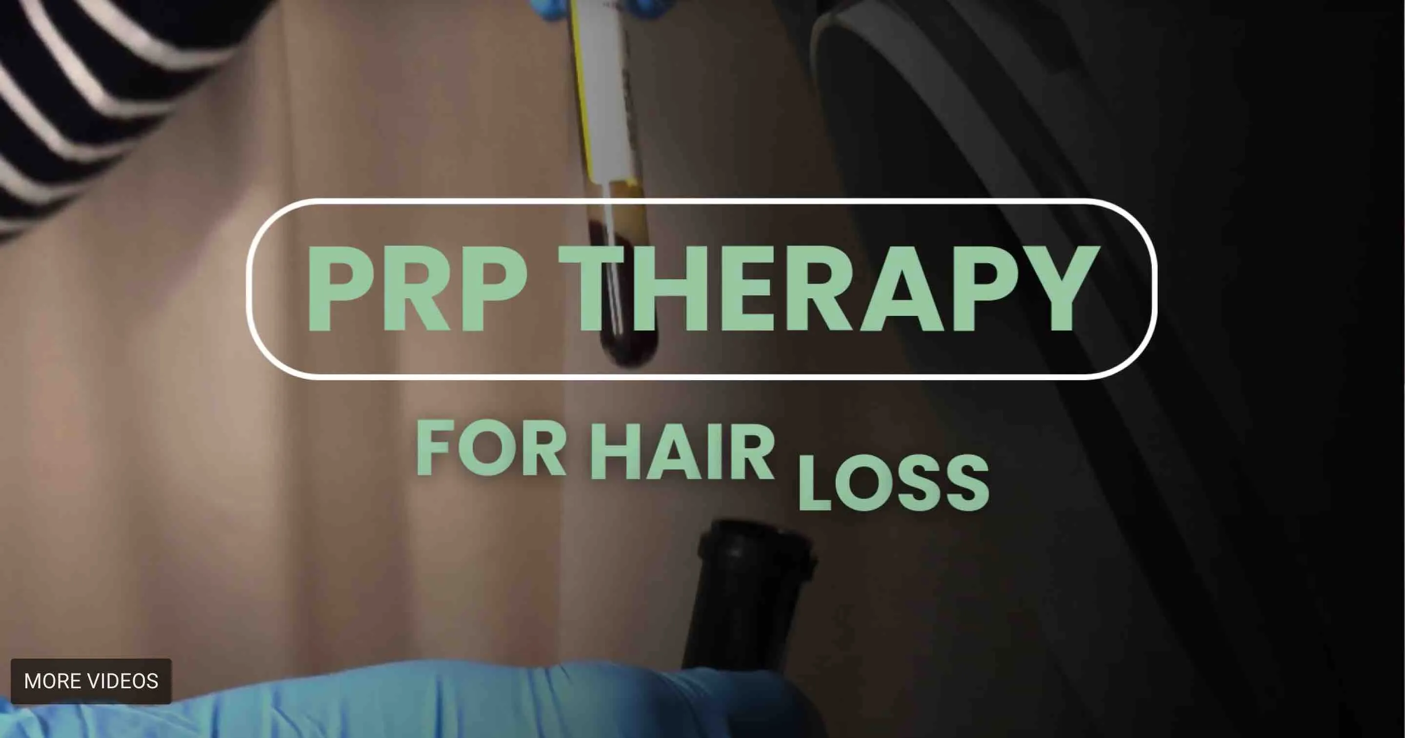 PRP for Hair Loss in Richmond Hill