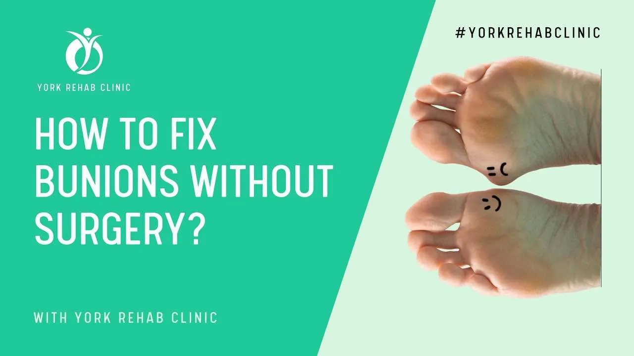 how to fix bunions without surgery | bunions Treatment in Richmond Hill